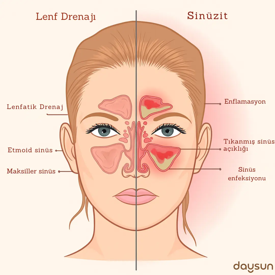 DueBrush™ - Şişkin Yüzlere Elveda- Daysun